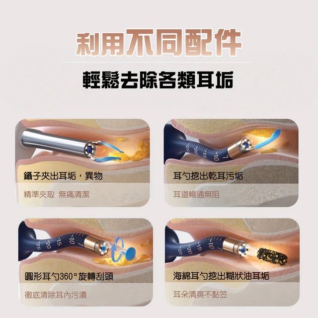 bebird – 多功能彎曲定型掏耳棒 無線智能可視採耳棒 耳挖 耳道清潔棒 耳勺│I35R - Image 4