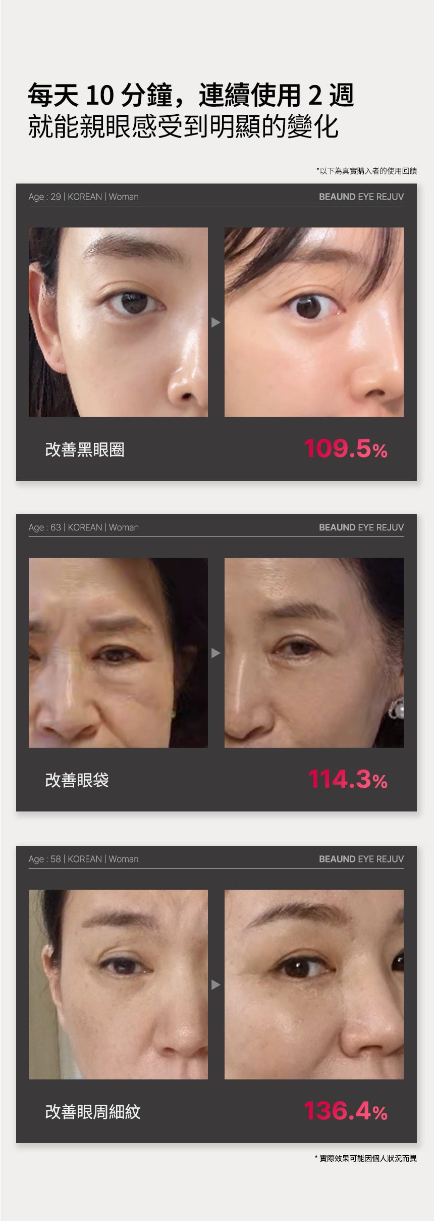 韓國 Beaund 8211 Eye Rejuv 眼部保養儀 香港行貨1年保養