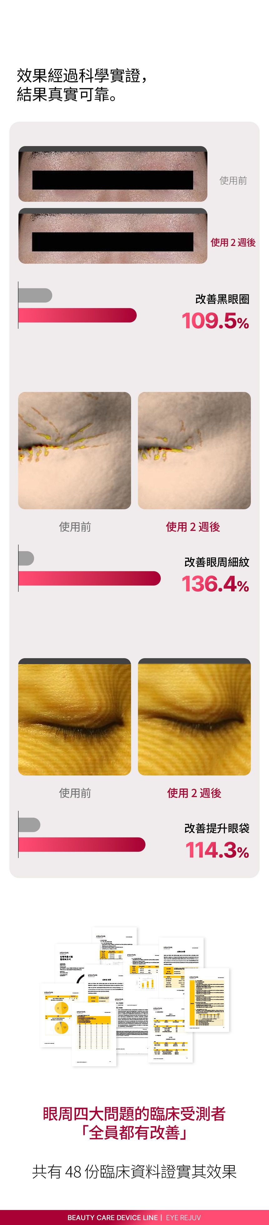 韓國 Beaund 8211 Eye Rejuv 眼部保養儀 香港行貨1年保養