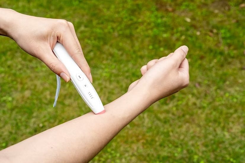 SORBO 物理熱脈衝止痕筆 30秒快速止癢 4檔控溫 無化學成分 可重複使用 蚊叮蟲咬救星